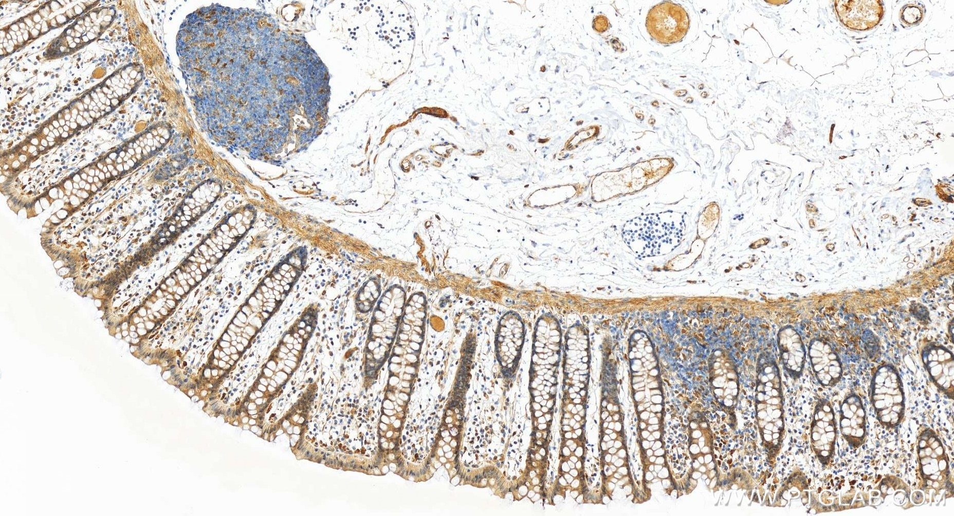 Immunohistochemistry (IHC) staining of human colon tissue using TIGAR Recombinant antibody (85052-4-RR)