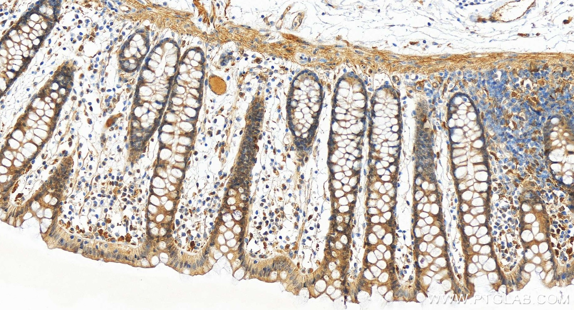 Immunohistochemistry (IHC) staining of human colon tissue using TIGAR Recombinant antibody (85052-4-RR)