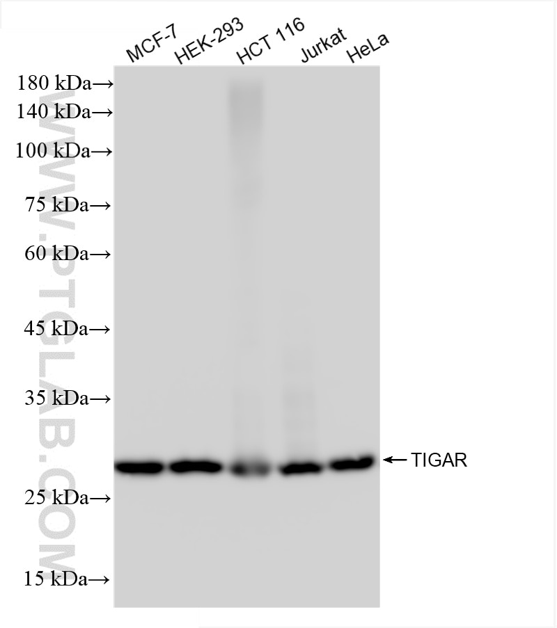 Western Blot (WB) analysis of various lysates using TIGAR Recombinant antibody (85052-4-RR)