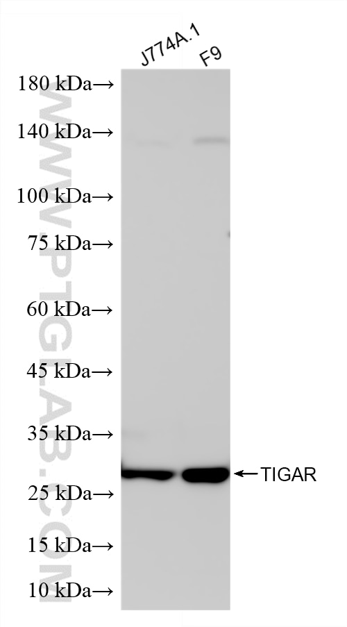 Western Blot (WB) analysis of various lysates using TIGAR Recombinant monoclonal antibody (85052-4-RR)