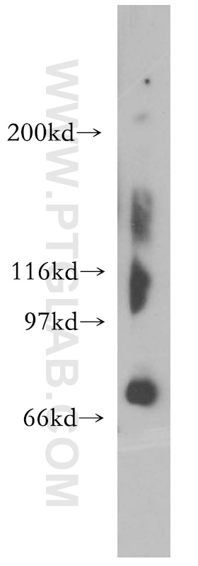 Western Blot (WB) analysis of human brain tissue using TIGD1 Polyclonal antibody (13833-1-AP)