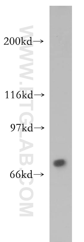 Western Blot (WB) analysis of HepG2 cells using TIGD1 Polyclonal antibody (13833-1-AP)