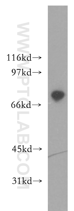 Western Blot (WB) analysis of human cerebellum tissue using TIGD1 Polyclonal antibody (13833-1-AP)