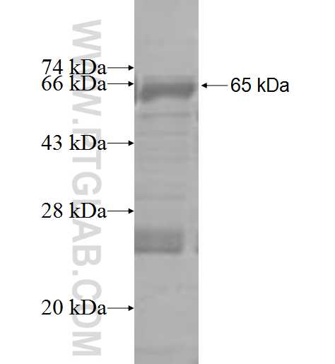 TIGD1 fusion protein Ag4757 SDS-PAGE