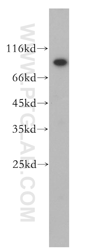 Western Blot (WB) analysis of HeLa cells using TIGD5 Polyclonal antibody (13644-1-AP)