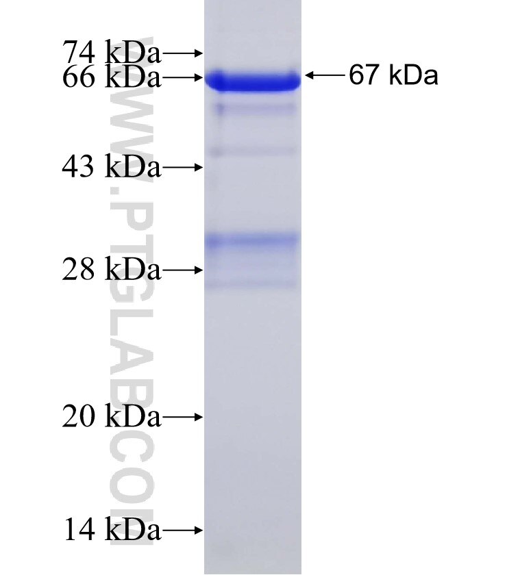 TIGD5 fusion protein Ag4590 SDS-PAGE