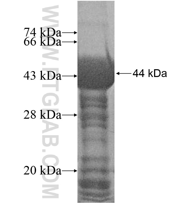 TIGD7 fusion protein Ag16539 SDS-PAGE