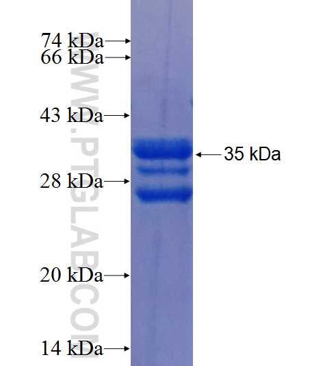 TIGIT fusion protein Ag26003 SDS-PAGE