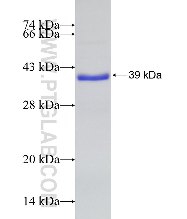 TIGIT fusion protein Ag16158 SDS-PAGE