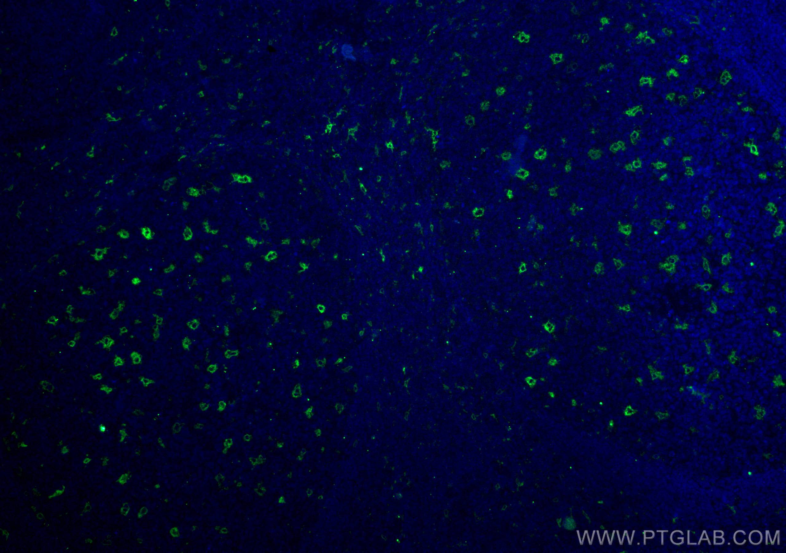 Immunofluorescence (IF) / fluorescent staining of human tonsillitis tissue using TIMD4 Polyclonal antibody (12008-1-AP)