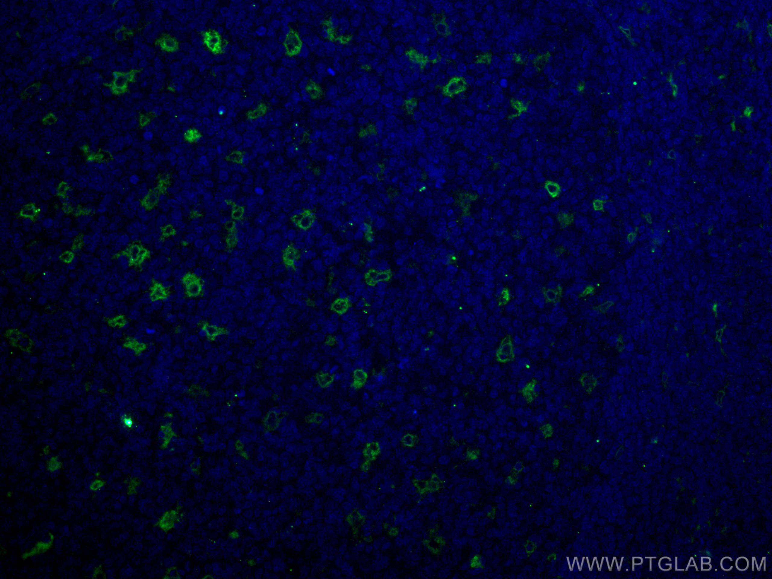 Immunofluorescence (IF) / fluorescent staining of human tonsillitis tissue using TIMD4 Polyclonal antibody (12008-1-AP)