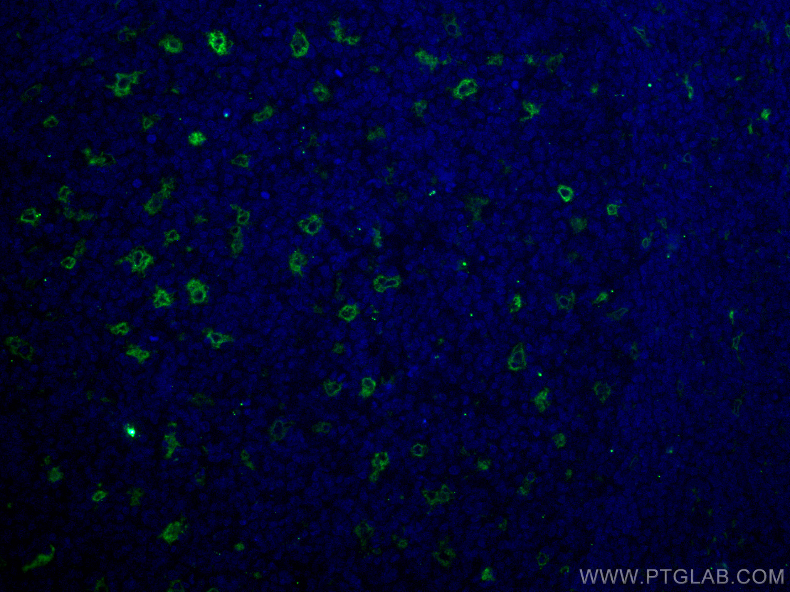 IF Staining of human tonsillitis using 12008-1-AP