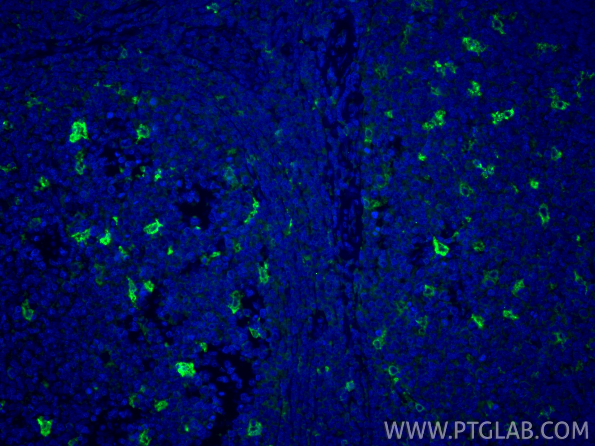 Immunofluorescence (IF) / fluorescent staining of human tonsillitis tissue using TIM4 Polyclonal antibody (12008-1-AP)