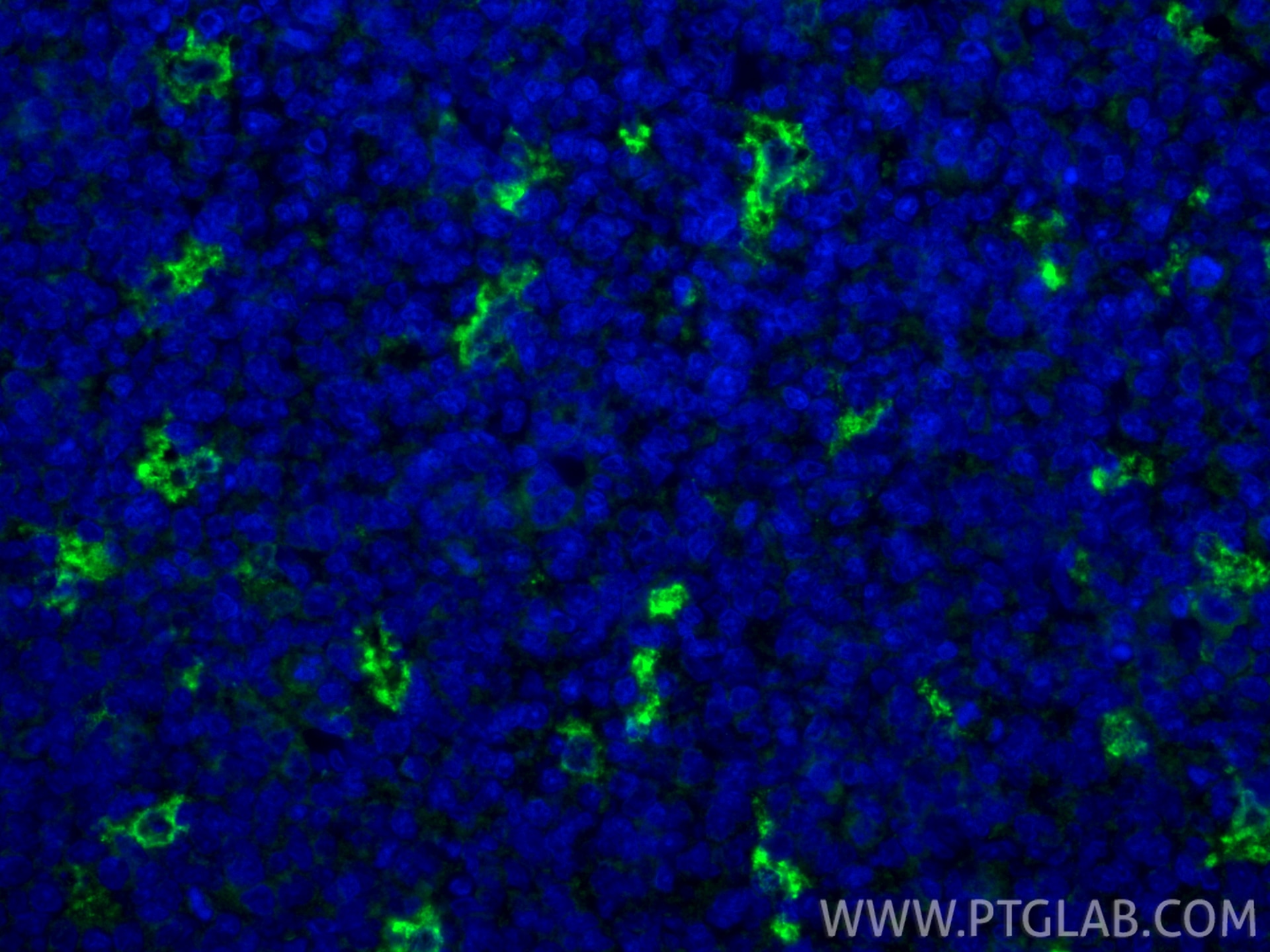 Immunofluorescence (IF) / fluorescent staining of human tonsillitis tissue using TIM4 Polyclonal antibody (12008-1-AP)