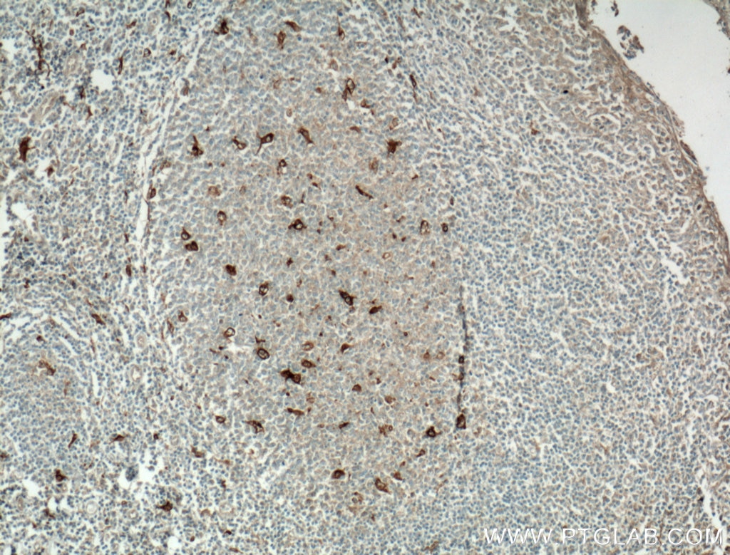 Immunohistochemistry (IHC) staining of human tonsillitis tissue using TIMD4 Polyclonal antibody (12008-1-AP)
