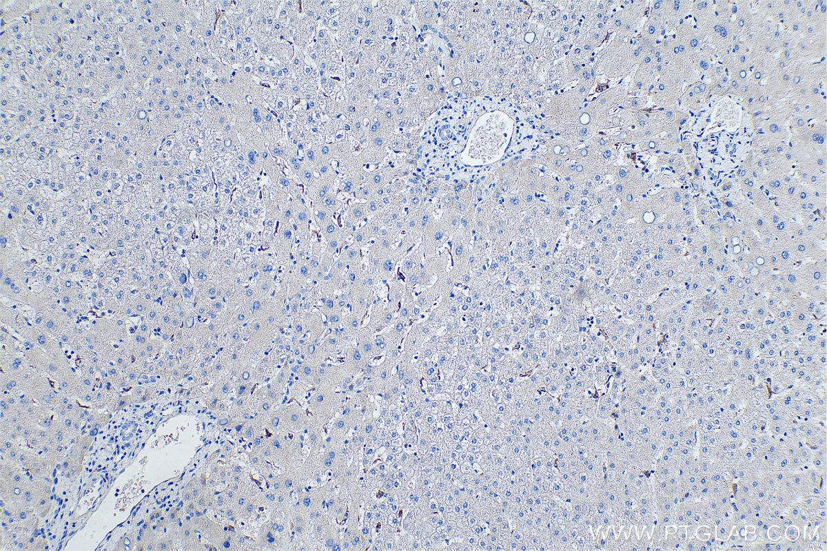 Immunohistochemistry (IHC) staining of human liver tissue using TIMD4 Polyclonal antibody (12008-1-AP)