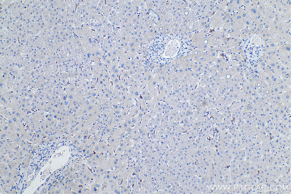 Immunohistochemistry (IHC) staining of human liver tissue using TIMD4 Polyclonal antibody (12008-1-AP)