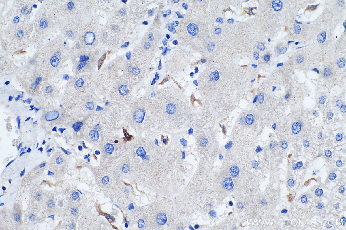 IHC staining of human liver using 12008-1-AP