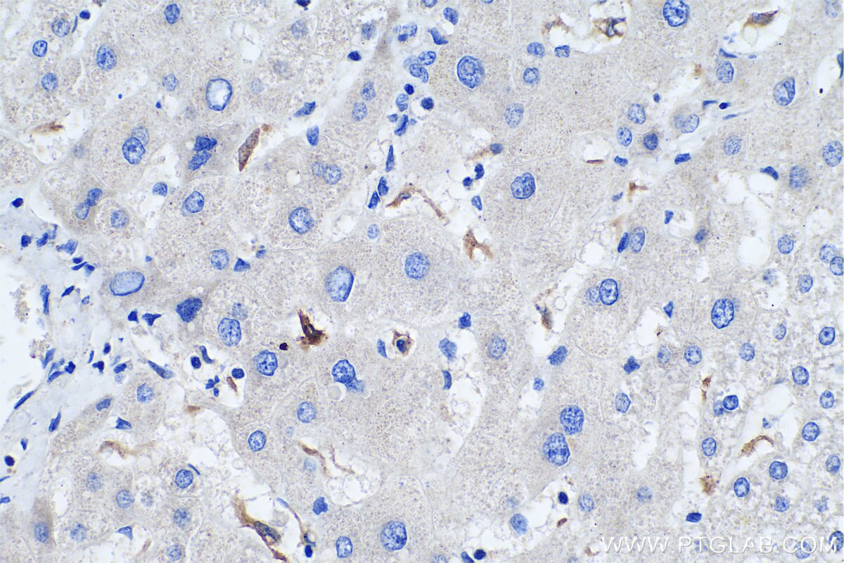 Immunohistochemistry (IHC) staining of human liver tissue using TIMD4 Polyclonal antibody (12008-1-AP)