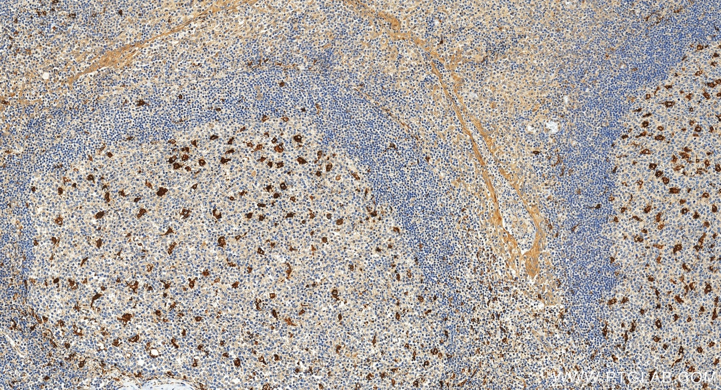 Immunohistochemistry (IHC) staining of human tonsillitis tissue using TIM4 Polyclonal antibody (12008-1-AP)