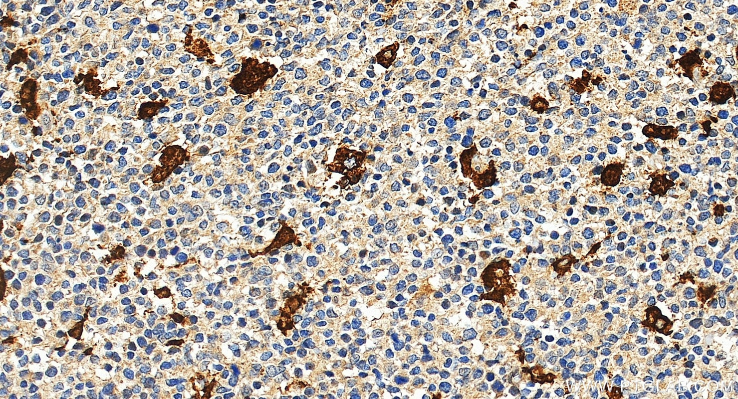 Immunohistochemistry (IHC) staining of human tonsillitis tissue using TIM4 Polyclonal antibody (12008-1-AP)