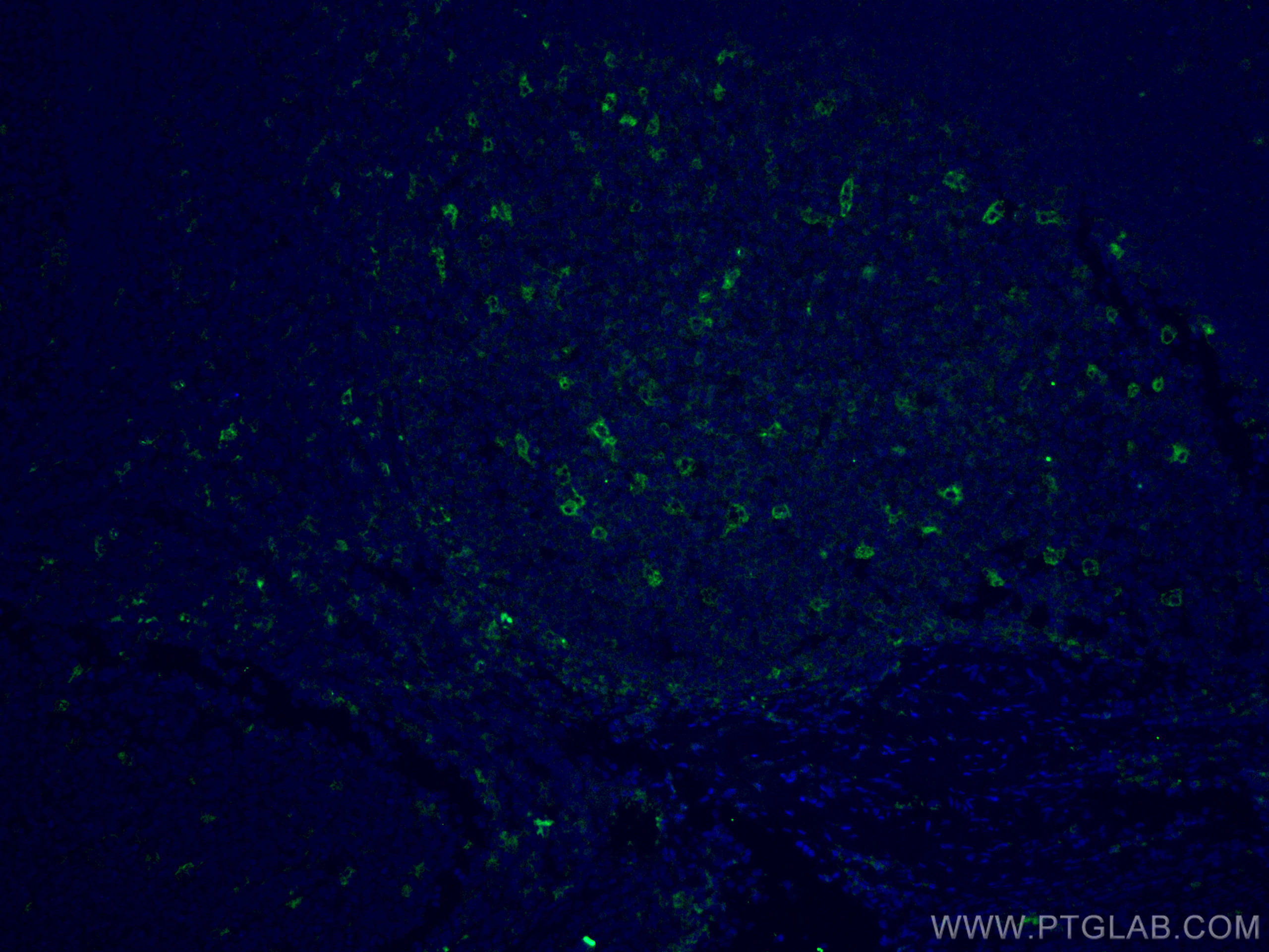 Immunofluorescence (IF) / fluorescent staining of human tonsillitis tissue using CoraLite® Plus 488-conjugated TIMD4 Polyclonal ant (CL488-12008)