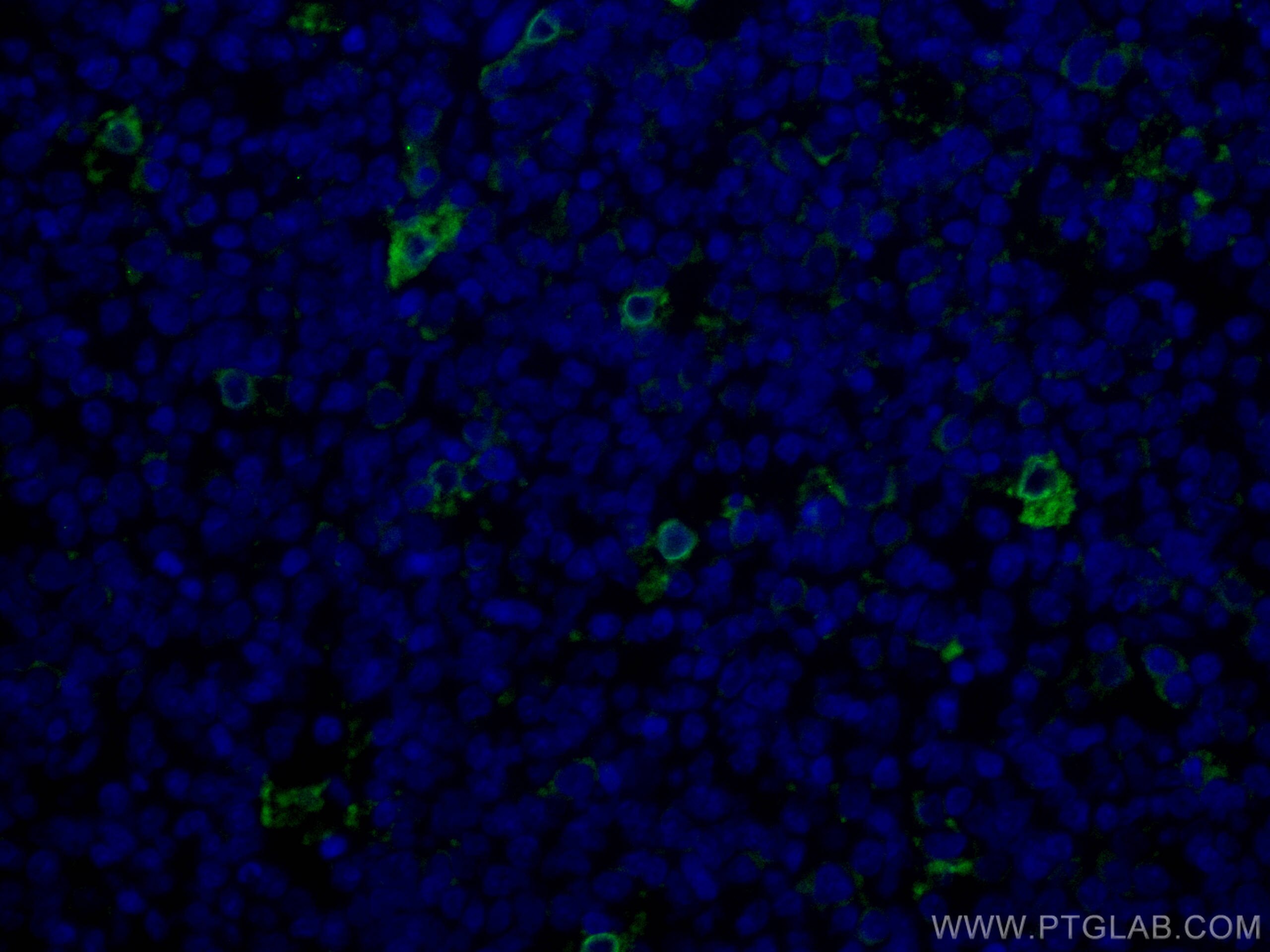 Immunofluorescence (IF) / fluorescent staining of human tonsillitis tissue using CoraLite® Plus 488-conjugated TIMD4 Polyclonal ant (CL488-12008)
