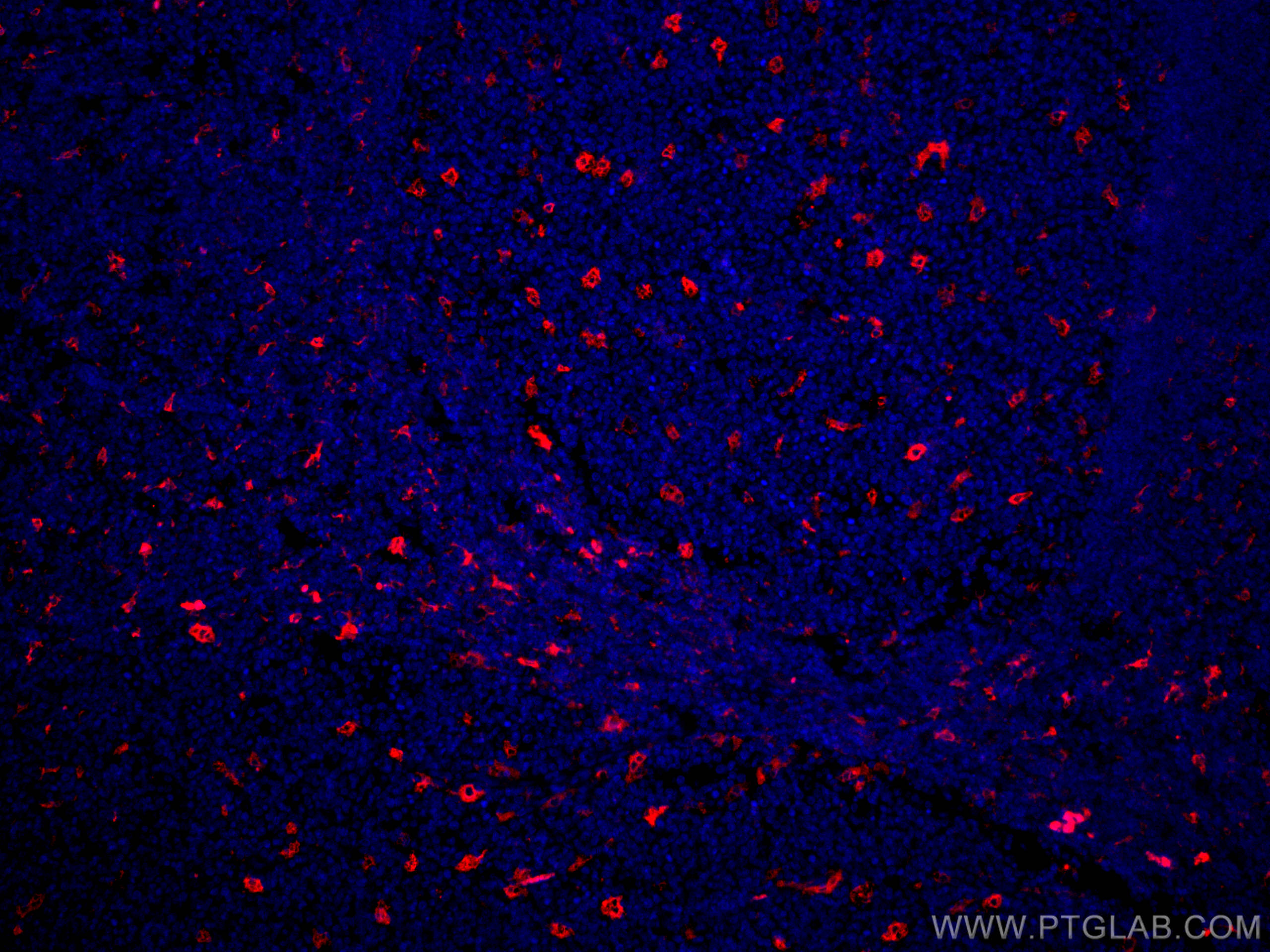 Immunofluorescence (IF) / fluorescent staining of human tonsillitis tissue using CoraLite®594-conjugated TIMD4 Polyclonal antibody (CL594-12008)