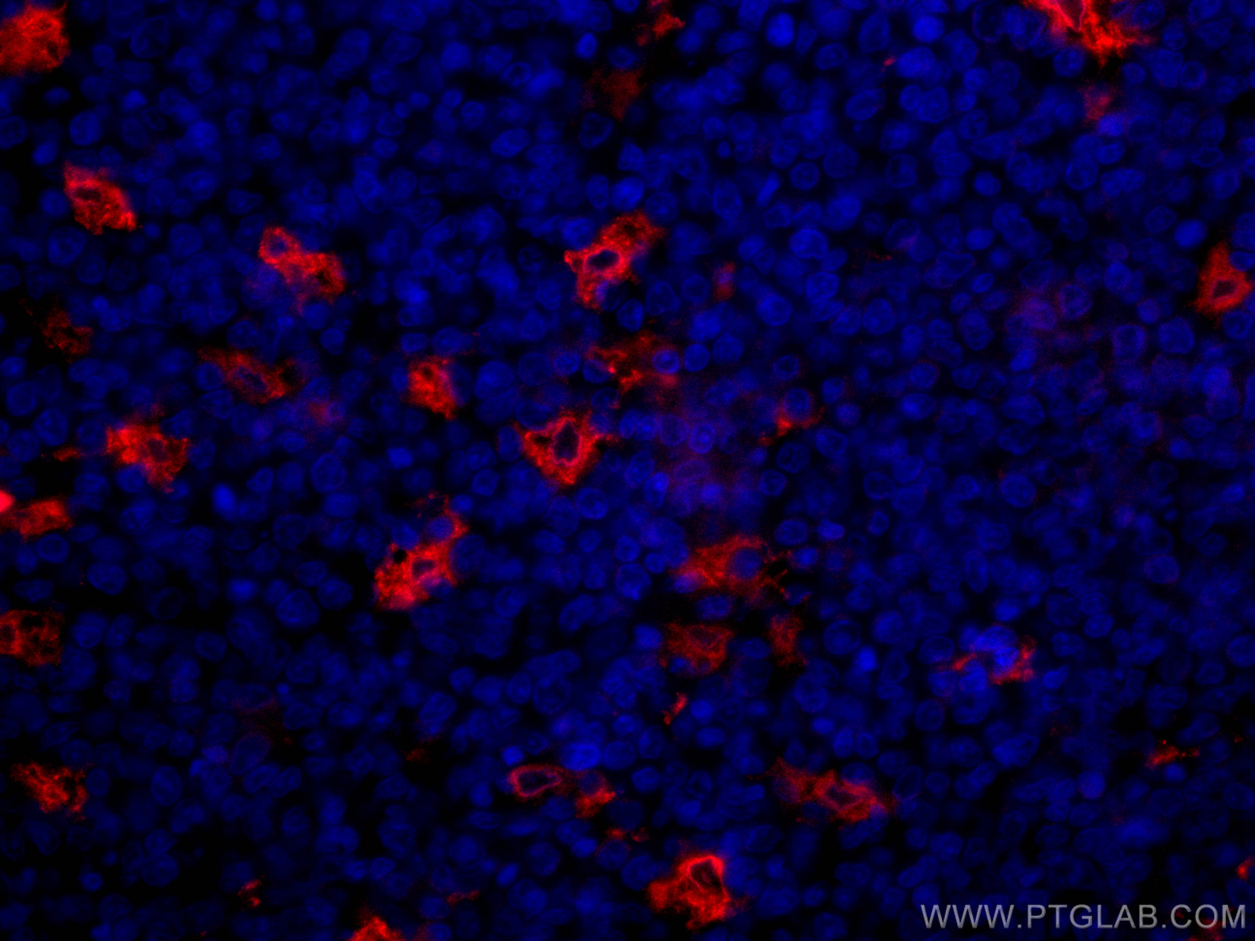 Immunofluorescence (IF) / fluorescent staining of human tonsillitis tissue using CoraLite®594-conjugated TIMD4 Polyclonal antibody (CL594-12008)