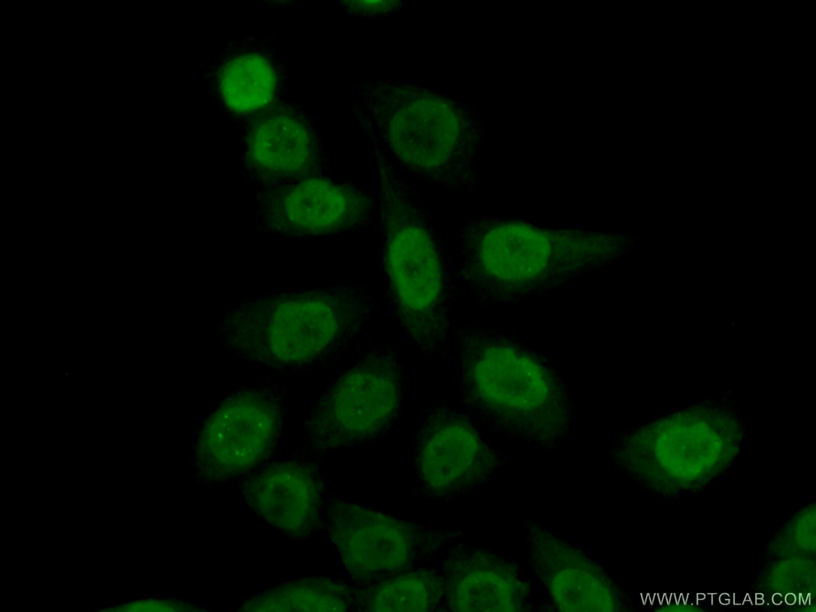 Immunofluorescence (IF) / fluorescent staining of HeLa cells using TIMELESS Polyclonal antibody (14421-1-AP)