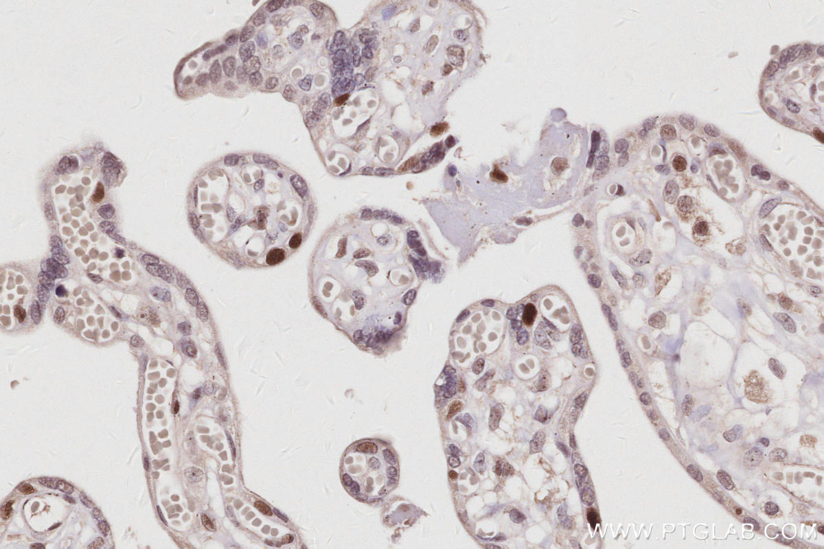 Immunohistochemistry (IHC) staining of human placenta tissue using TIMELESS Polyclonal antibody (14421-1-AP)