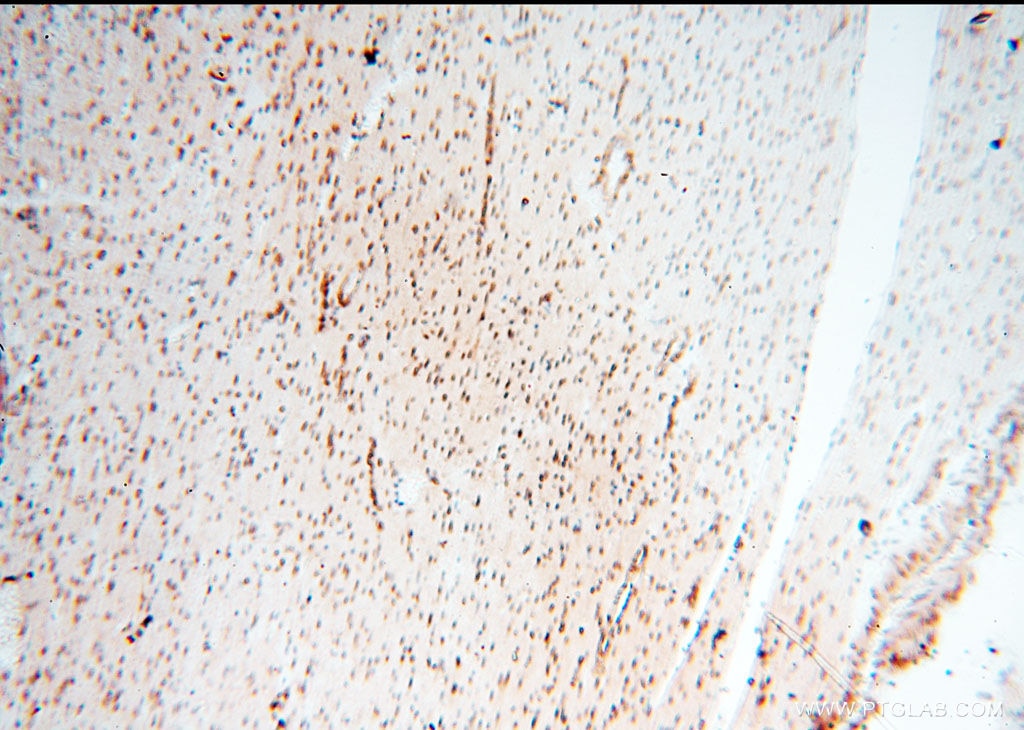 Immunohistochemistry (IHC) staining of human heart tissue using TIMELESS Polyclonal antibody (14421-1-AP)