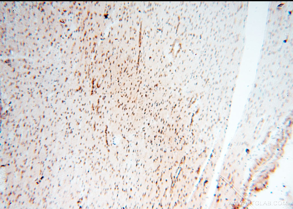 IHC staining of human heart using 14421-1-AP