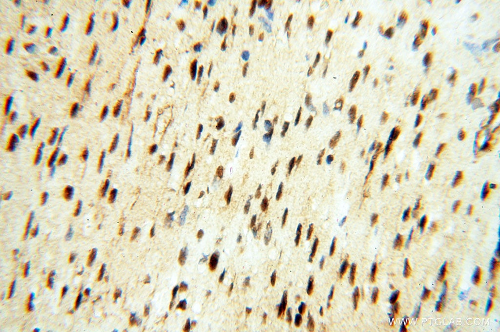IHC staining of human heart using 14421-1-AP