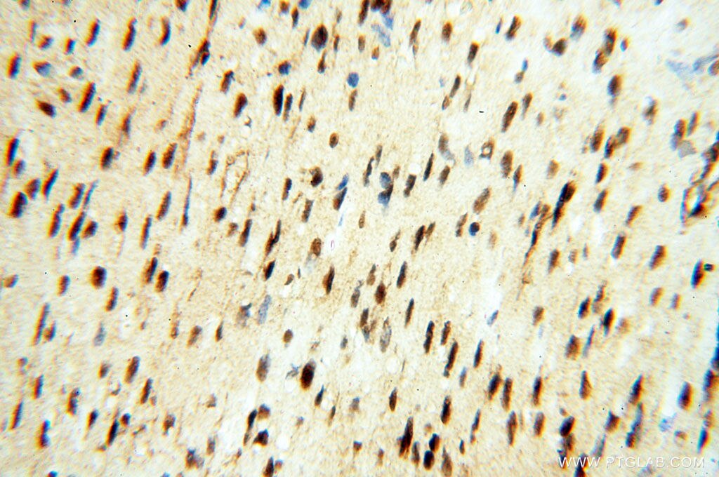 Immunohistochemistry (IHC) staining of human heart tissue using TIMELESS Polyclonal antibody (14421-1-AP)