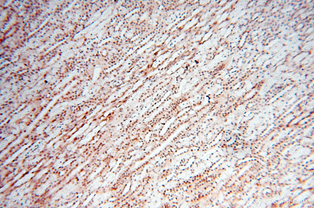 Immunohistochemistry (IHC) staining of human kidney tissue using TIMELESS Polyclonal antibody (14421-1-AP)