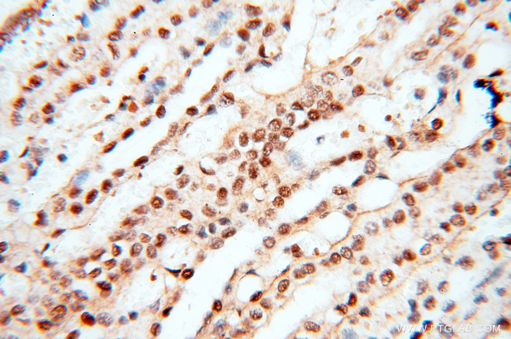 Immunohistochemistry (IHC) staining of human kidney tissue using TIMELESS Polyclonal antibody (14421-1-AP)