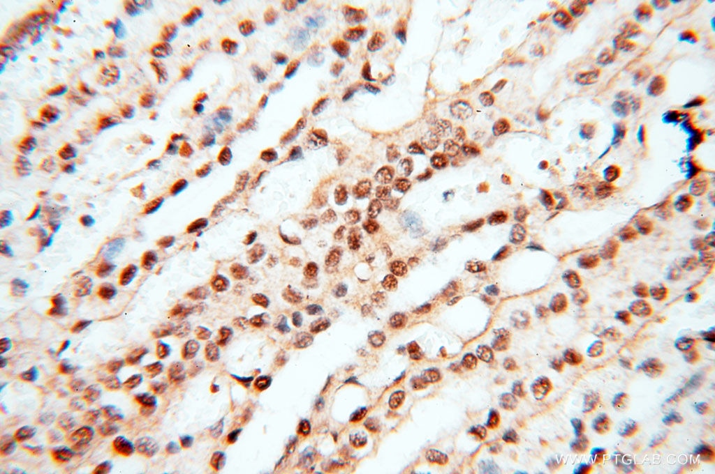 IHC staining of human kidney using 14421-1-AP