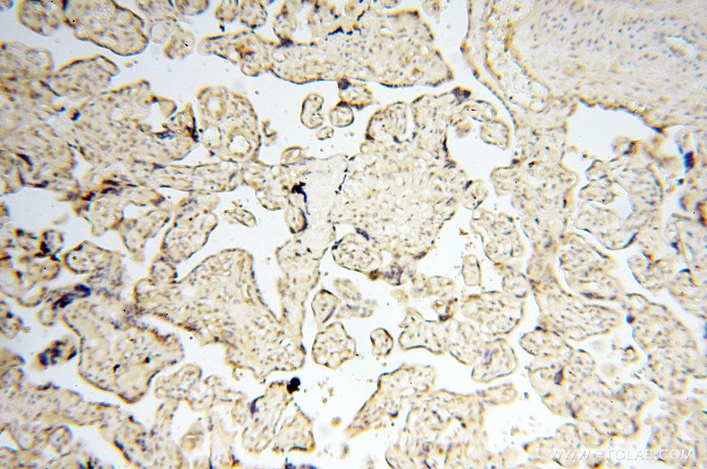 Immunohistochemistry (IHC) staining of human placenta tissue using TIMELESS Polyclonal antibody (14421-1-AP)