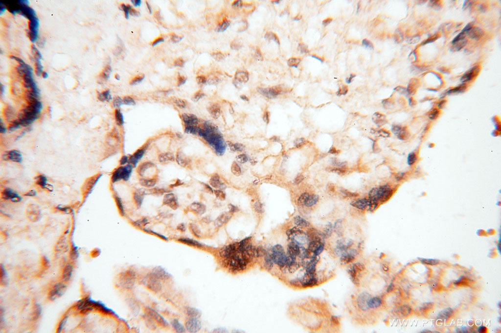 Immunohistochemistry (IHC) staining of human placenta tissue using TIMELESS Polyclonal antibody (14421-1-AP)