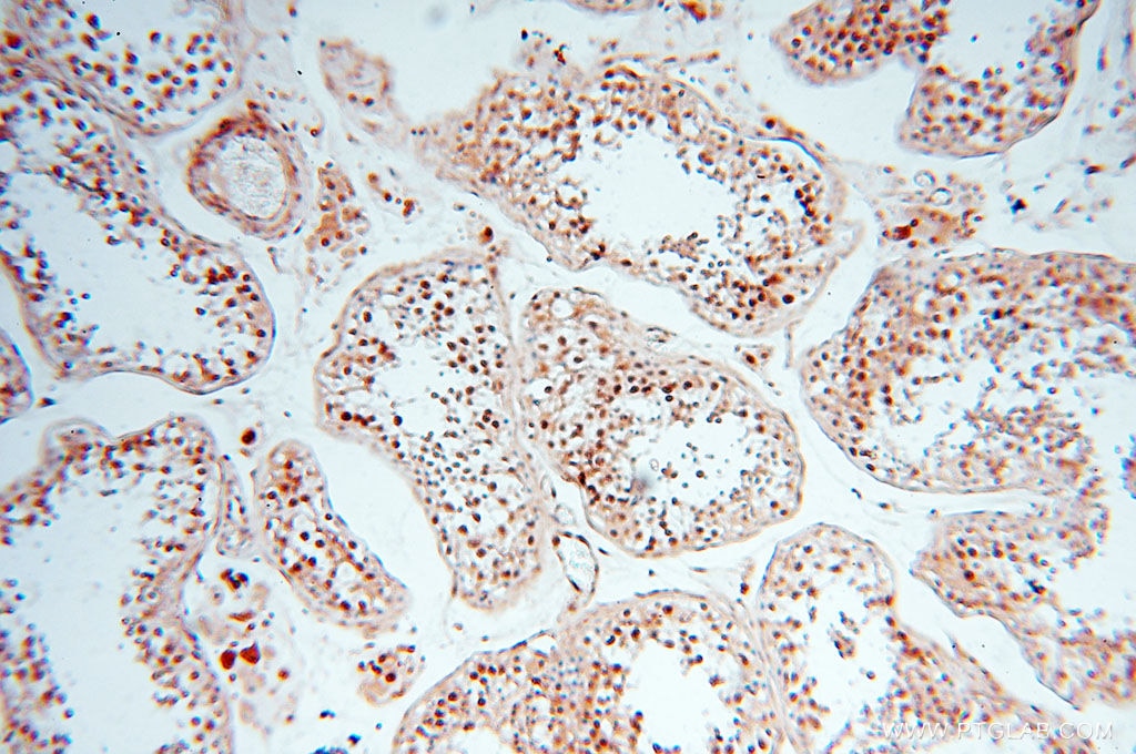 Immunohistochemistry (IHC) staining of human testis tissue using TIMELESS Polyclonal antibody (14421-1-AP)