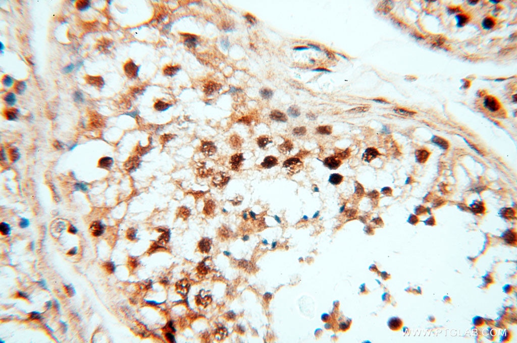 Immunohistochemistry (IHC) staining of human testis tissue using TIMELESS Polyclonal antibody (14421-1-AP)