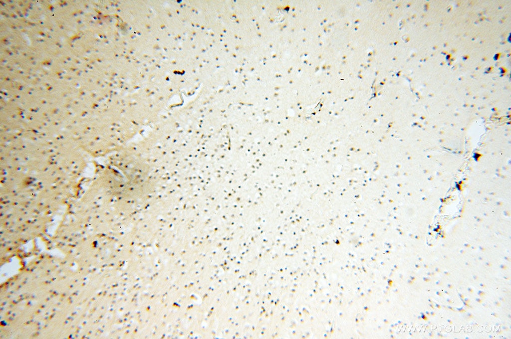 Immunohistochemistry (IHC) staining of human brain tissue using TIMELESS Polyclonal antibody (14421-1-AP)