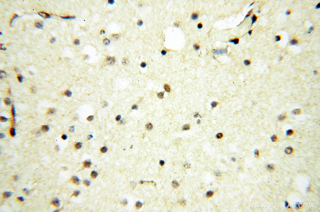 Immunohistochemistry (IHC) staining of human brain tissue using TIMELESS Polyclonal antibody (14421-1-AP)