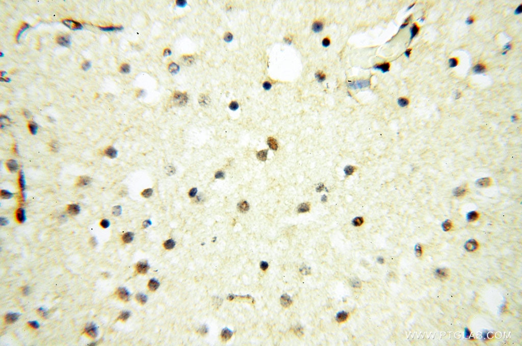 IHC staining of human brain using 14421-1-AP