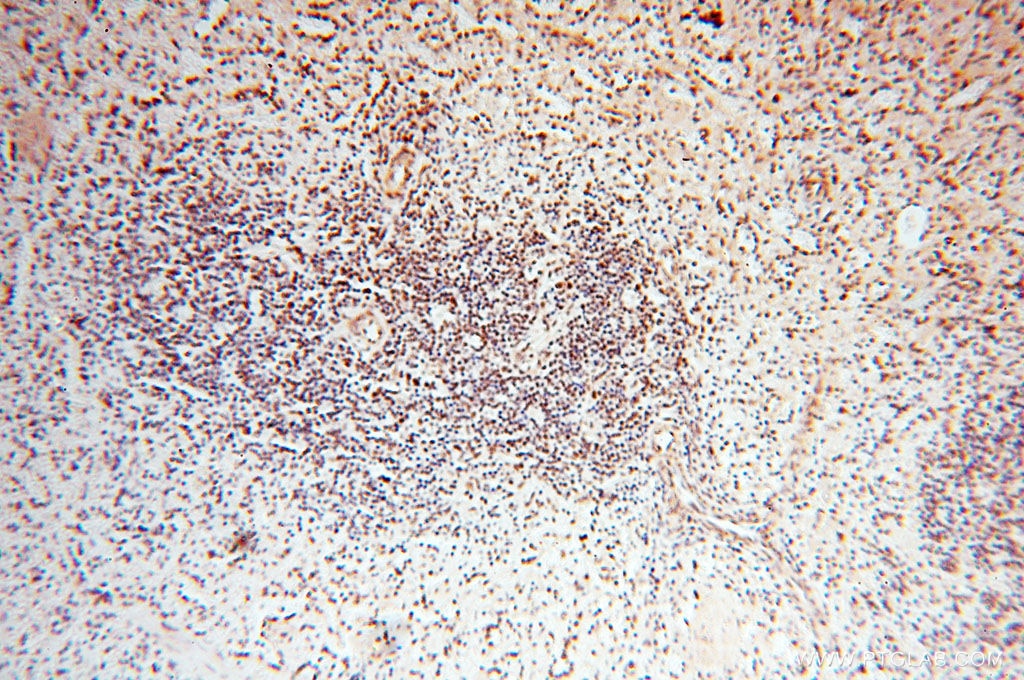 Immunohistochemistry (IHC) staining of human spleen tissue using TIMELESS Polyclonal antibody (14421-1-AP)