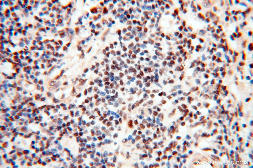 Immunohistochemistry (IHC) staining of human spleen tissue using TIMELESS Polyclonal antibody (14421-1-AP)