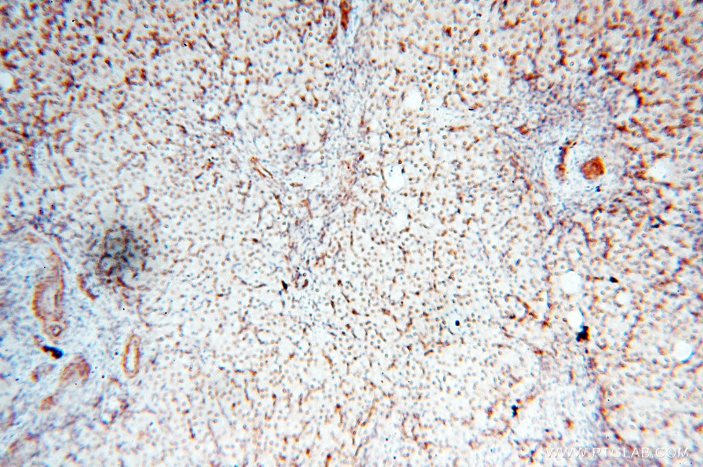IHC staining of human ovary using 14421-1-AP