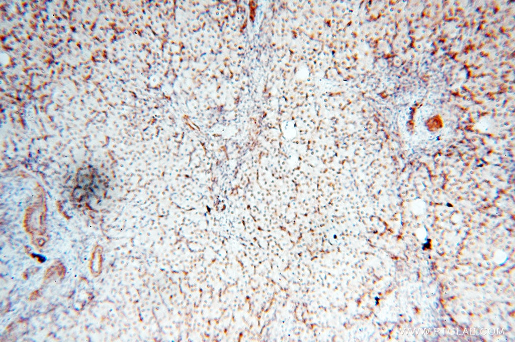 Immunohistochemistry (IHC) staining of human ovary tissue using TIMELESS Polyclonal antibody (14421-1-AP)