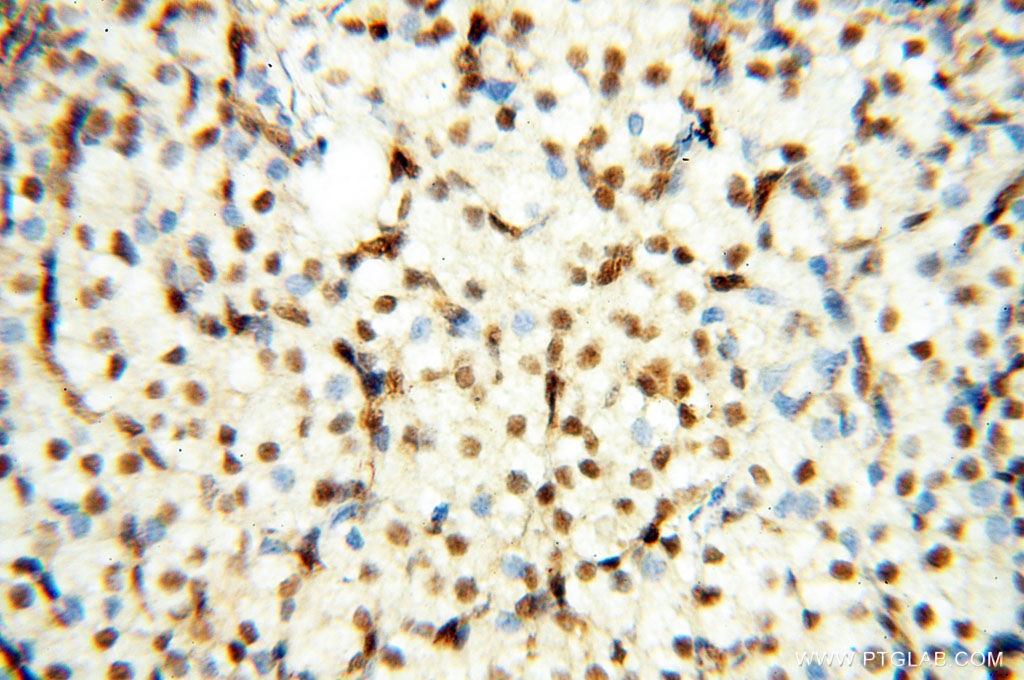 Immunohistochemistry (IHC) staining of human ovary tissue using TIMELESS Polyclonal antibody (14421-1-AP)